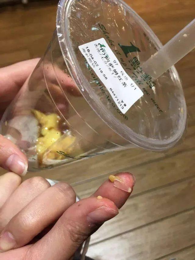 女子口吐黑虫最新进展